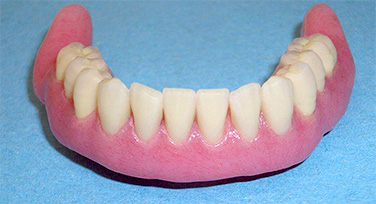 Immagine di una protesi mobile completa inferiore o dentiera inferiore